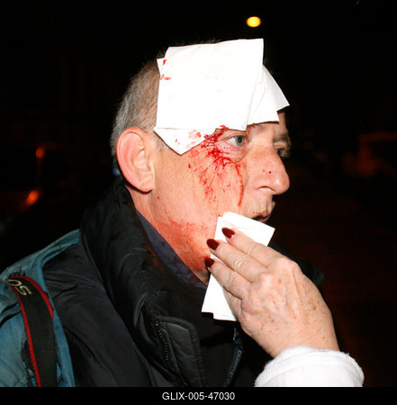 Molotovval ünnepelt a Magyar Önvédelmi Mozgalom-stock-foto