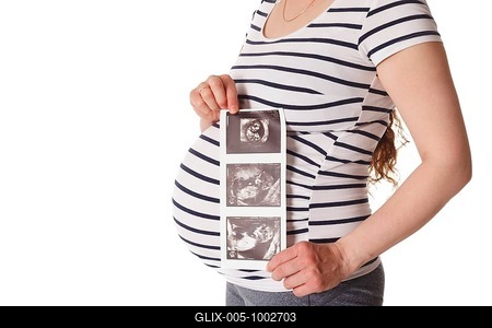 Pregnant woman standing and holding her ultrasound baby scan picture isolated on white-stock-foto