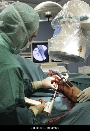 Surgery of a shoulder, instrument checking the correct fixing of bone-screw-stock-foto