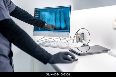 Dentist pointing at a dental x ray on a computer screen, showcasing modern dental diagnostics in a bright, clean clinic environment-stock-foto