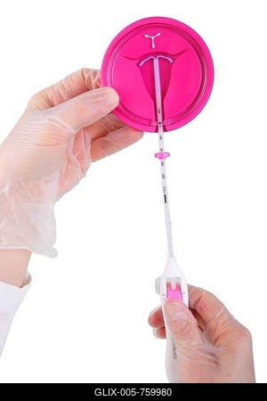 Jaydess, hormone IUD for three years by Jena Pharm, active ingredient levonorgestrel, basic model of a uterus with an intrauterine contraceptive device, contraception-stock-foto