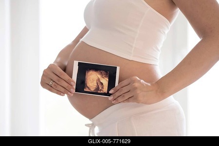 Woman in her ninth month pregnant, holds photo of fetus in front of abdomen, ultrasonic image, Germany-stock-foto