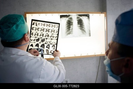 Tuberculosis in Moldova, meeting at the physicians' office, hospital Balti, Balti, Moldova-stock-foto
