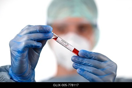 Positive test result, medical staff with mouthguards, corona test, corona crisis, Baden-Württemberg, Germany-stock-foto