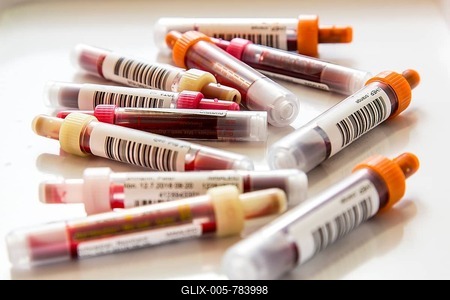 Blood samples, in blood collection tubes, sample container for collection and preparation of blood samples, barcode for identification, Germany-stock-foto