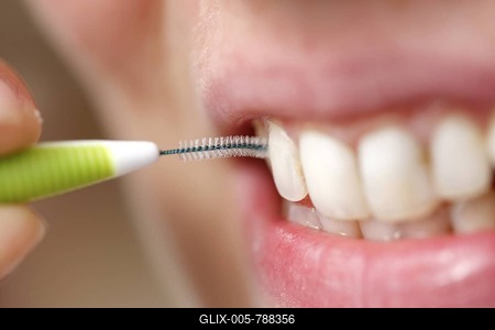 Young woman brushing her teeth with a special interdental toothbrush-stock-foto