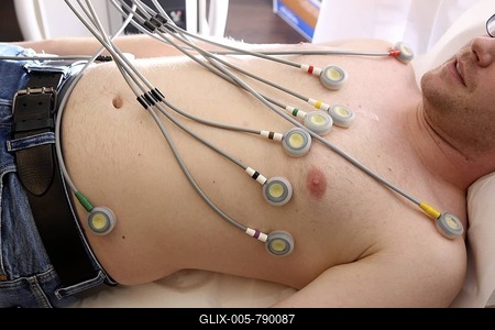 Medical practice, ECG recording, measuring the cardiac function of a patient-stock-foto