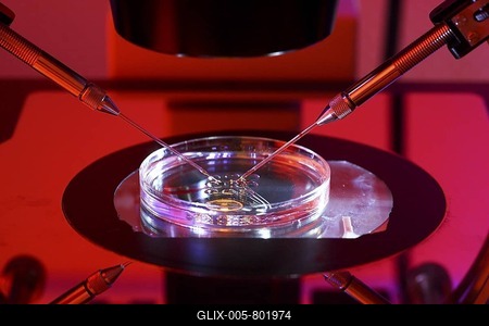 Artificial insemination using the ICSI method, intracytoplasmic sperm injection, under the microscope, Centre for Reproductive Medicine, Centre for Fertility Treatment, private clinic in Duesseldorf, North Rhine-Westphalia, Germany, Europe-stock-foto