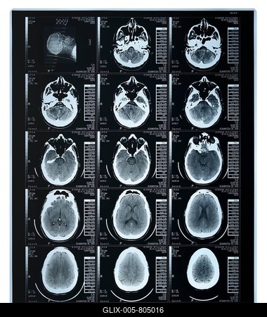 Scan of a human brain-stock-foto