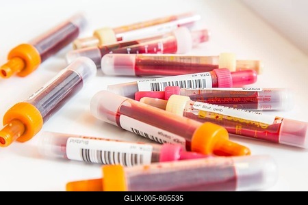 Blood samples, in blood collection tubes, sample container for collection and preparation of blood samples, barcode for identification, Germany-stock-foto