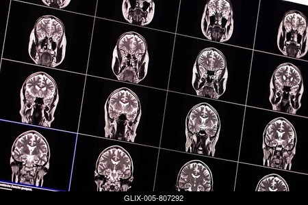 Several MRI images of a human brain in black and white, arranged in a grid view-stock-foto