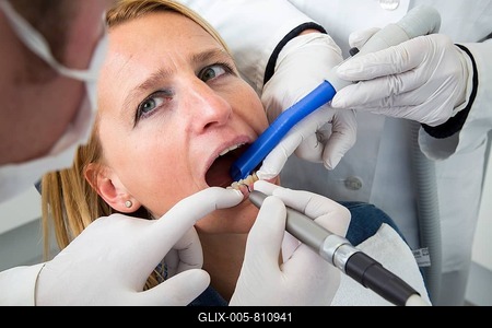 Woman receiving treatment at the dentist, Germany-stock-foto