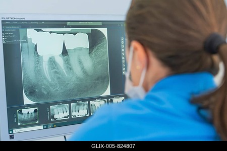Dentist analysing X-ray images of teeth on a computer screen, dental practice, Germany-stock-foto