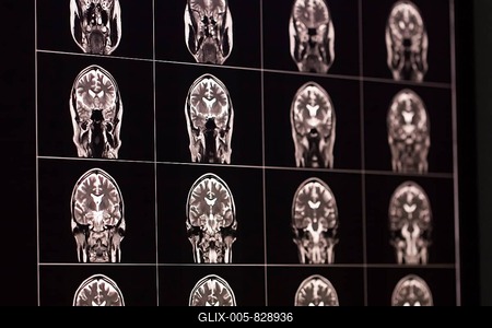 MRI scans of a brain in black and white, organised in a matrix, show different sections-stock-foto