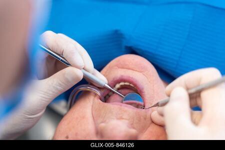 Dental clinic, detail of the hands of a doctor checking the teeth of an elderly woman with a small mirror-stock-foto