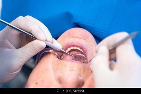 Dental clinic, detail of a doctor's hands checking the teeth of an elderly woman-stock-foto