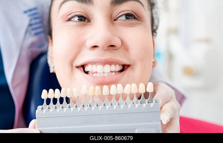 Dentist holding a set of implants with various shades of tone. Patient selecting the shade of dental implant. Implant tooth shade selection, Dentist showing dental prosthesis shades to patient-stock-foto