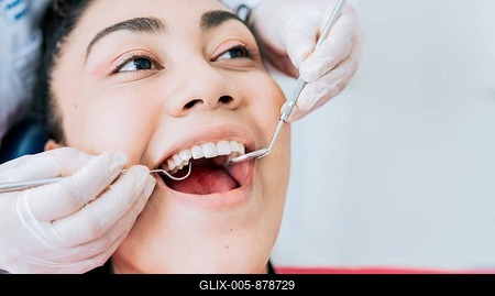 Close-up of the hands of a dentist cleaning the teeth of a female patient, Hands of a specialist dentist cleaning the teeth of a female patient. Close up of dentist hands cleaning patient teeth-stock-foto