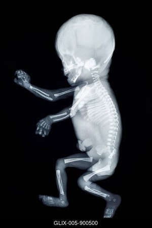 X-ray of a baby, side view-stock-foto