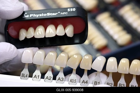 Dental laboratory, manufacture of dental prostheses by a master craftsman, comparing tooth colour based on colour samples, front teeth-stock-foto