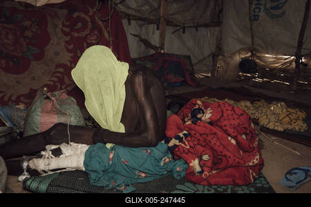  Sudanese refugees in Chad - 20/06/2024 - chad / ? Adre ? - A Sudanese refugee injured in the leg. Adre transit camp, J-stock-foto