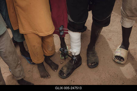  Sudanese refugees in Chad - 22/06/2024 - chad / ? Adre ? - Sudanese refugees in Chad PUBLICATIONxNOTxINxFRAxRUS Adrien-stock-foto