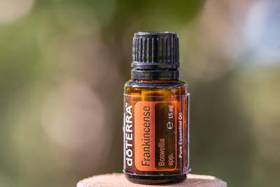 Pecs / Hungray - Aug 21 2020 - Illustrative editorial image of Doterra Essential  Oil for everyday use-stock-foto
