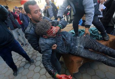 People transport the bodies and injured Palestinians to Al-Aqsa Martyrs Hospital after an Israeli air strike targeted the Deir al-Balah municipality-stock-photo