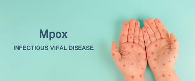 Mpox, hands with monkeypox rash, outbreak of the MPXV virus, infectious viral disease spreading Mpox, hands with monkeyp-stock-foto