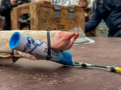 Die Feuerwehr Hamburg zeigt, wie gef?hrlich illegales Feuerwerk sein kann. Anhand einer Schweinepfote, die einer menschl-stock-photo