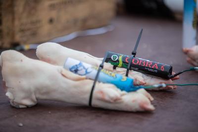 Die Feuerwehr Hamburg zeigt, wie gef?hrlich illegales Feuerwerk sein kann. Anhand einer Schweinepfote, die einer menschl-stock-photo
