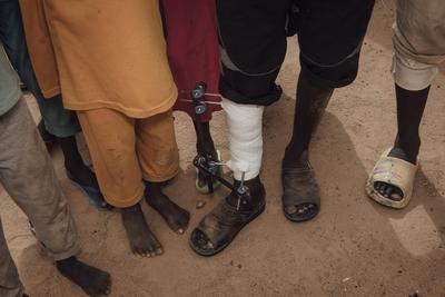  Sudanese refugees in Chad - 22/06/2024 - chad / ? Adre ? - Sudanese refugees in Chad PUBLICATIONxNOTxINxFRAxRUS Adrien-stock-photo
