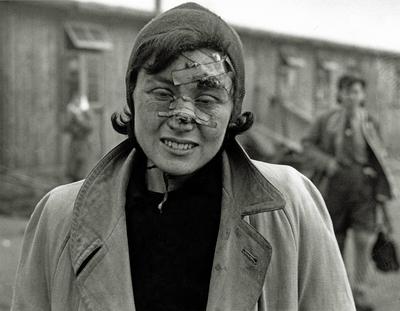 KZ Bergen Belsen Eine verletzte Frau hat die Schrecken des Lagers das von der Allied 21st Army Grou-stock-foto