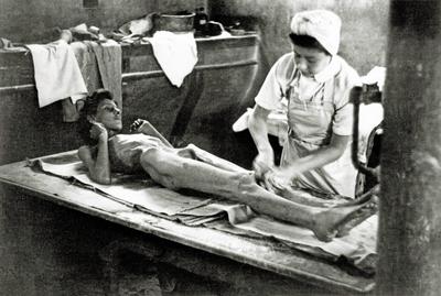 KZ Bergen-Belsen Die Behandlung eines ?berlebenden nach dem Lager wurde von der Allied 21st Army Group ?bernommen. Im L-stock-foto