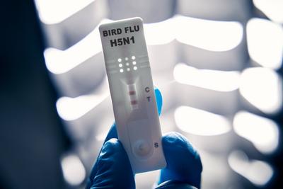 Germany - 02 July 2024: Bird FLU HN51 test, or test cassette in a laboratory. Test for bird flu virus - influenza A viru-stock-foto