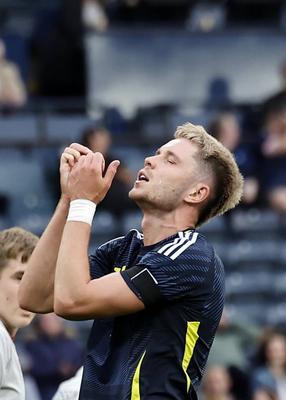 Scotland v IcelandInternational Friendly-stock-photo