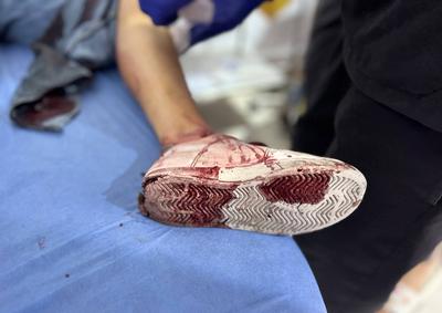 Palestinian casualties are brought to Al-Awda Hospital, following what the Gaza Health Ministry-stock-foto