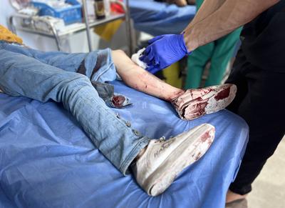 Palestinian casualties are brought to Al-Awda Hospital, following what the Gaza Health Ministry-stock-foto