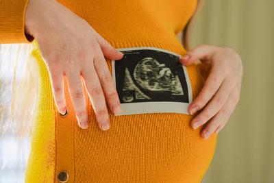 Pr?natale Ultraschalluntersuchung. Schwangere Frau H?nde halten Sonogramm Bild des ungeborenen Babys in gro?en Bauch. Gl?ckliche werdende Mutter mit F?tus usi Scan-Bild. Junge Mutter genie?t die Schwangerschaft. Mutterschaft.-stock-foto