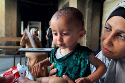 UNRWA health staff screen and treat children suffering from Severe Acute Malnutrition (SAM) at an UNRWA Medical Point located in an UNRWA school-turned-shelter-stock-foto