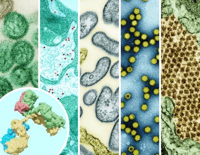 Pandemic Preparedness: Examples of High-Priority Prototype Pathogens-stock-foto
