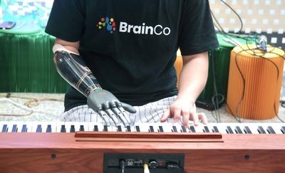 SHANGHAI, CHINA - JULY 27: An amputee plays the electronic keyboard using BrainCo s AI-powered mechanic arm at the exhib-stock-foto