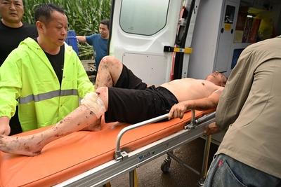 LUANPING, CHINA - JULY 29: An injured villager is sent to ambulance on July 29, 2025 in Luanping, Chengde City, Hebei Pr-stock-foto