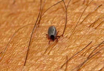 11.09.2024, Heimische Zecke sucht sich auf der menschlichen Haut eine Stelle zum Blut saugen. Gemeiner Holzbock (Ixodes-stock-foto