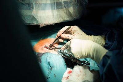 Operation im Krankenhaus mit offener Wunde und Wundklammer NUR F?R REDAKTIONELLE NUTZUNG - EDITORIAL USE ONLY Duesseldo-stock-foto