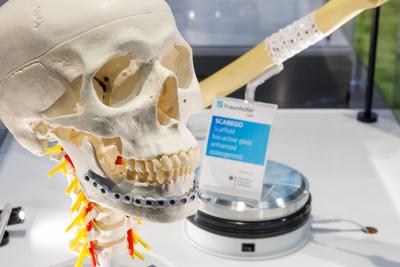 Highlights und Neuheiten der MEDICA 2025-stock-foto