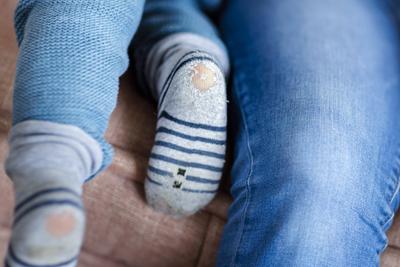 Thema: Kind mit kaputten Socken, Kinderarmut. Bonn Deutschland *** Theme child with broken socks, child poverty Bonn Ger-stock-foto