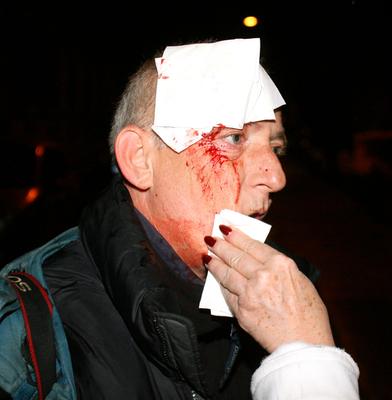 Molotovval ünnepelt a Magyar Önvédelmi Mozgalom-stock-foto